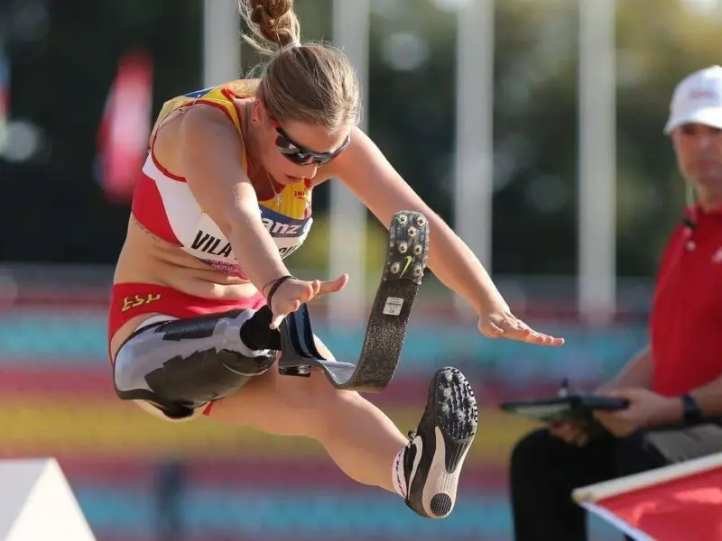 Desirée Vila after leg amputation surgery