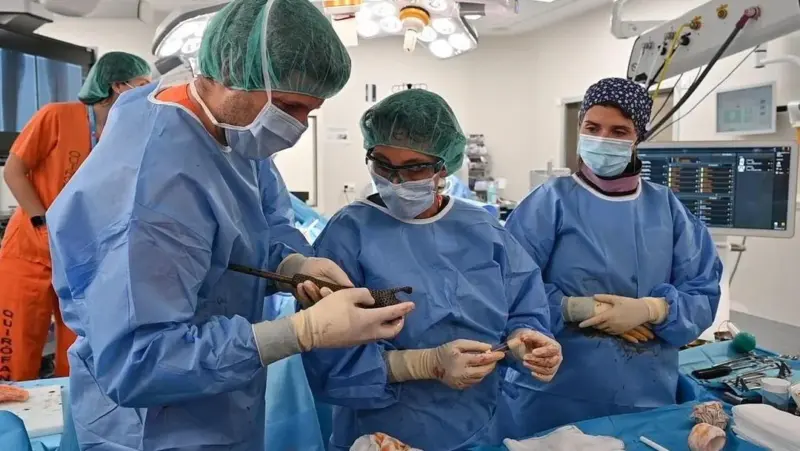 El Gregorio Marañón se convierte en el primer hospital del mundo en implantar una prótesis ósea de metamaterial