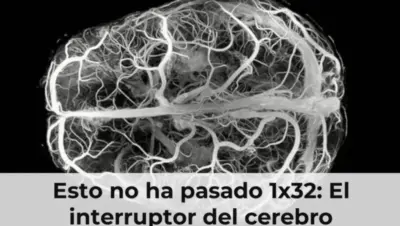 Esto no ha pasado 1x32: El interruptor del cerebro