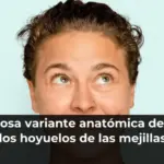 La curiosa variante anatómica detrás de los hoyuelos de las mejillas