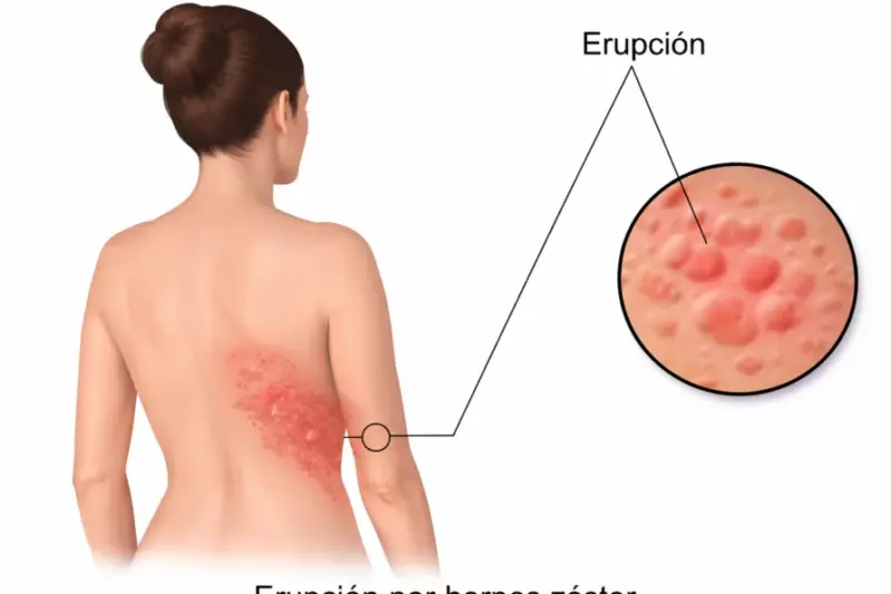 La vacuna que promete ser un escudo contra el infarto y las demencias como el alzhéimer (y tienes en tu centro de salud)