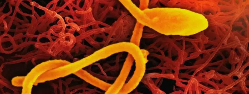 ¿Podría llegar el ébola a España? Lo que se sabe sobre la epidemia más rápida de los últimos años